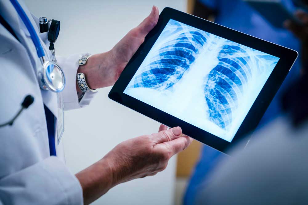 Doctor holding image of chest xray